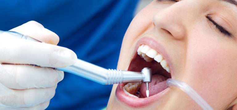 Diş Eti Hastalıkları ve Tedavisi FHM Dent Ağız ve Diş Sağlığı Polikliniği